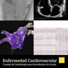 Enfermedad cardiovascular. Tratado de cardiología para estudiantes de grado